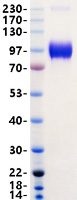 Recombinant Human ACE2 Protein