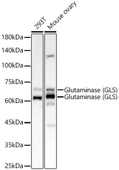 Glutaminase (GLS) Rabbit mAb