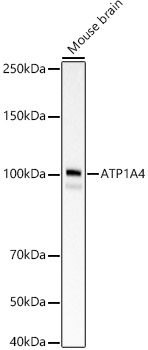 ATP1A4 Rabbit mAb