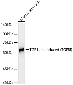 TGF beta induced (TGFBI)? Rabbit mAb