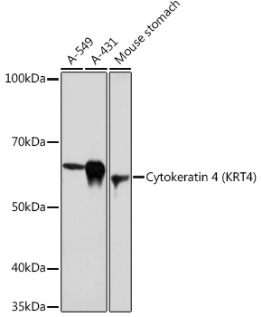 Cytokeratin 4 (KRT4) Rabbit mAb