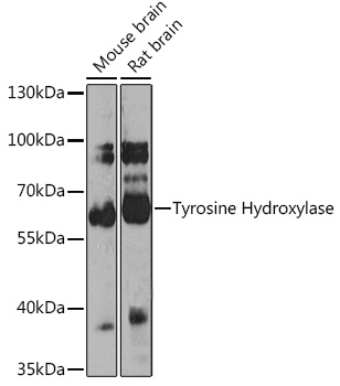 Tyrosine Hydroxylase Rabbit pAb