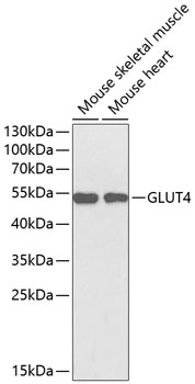 GLUT4 Mouse mAb