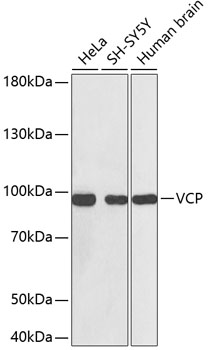 VCP Mouse mAb