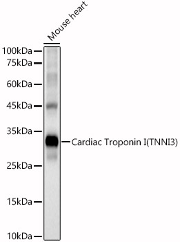 Cardiac Troponin I (TNNI3) Rabbit pAb