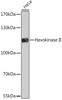 [KO Validated] Hexokinase II Rabbit pAb