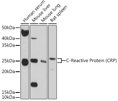 C-Reactive Protein (CRP) Rabbit pAb