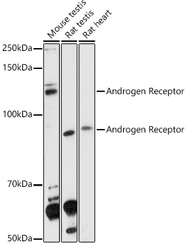 Androgen Receptor Rabbit pAb
