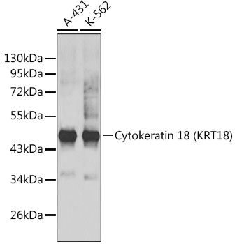 Cytokeratin 18 (KRT18) Rabbit pAb