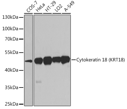 Cytokeratin 18 (KRT18) Mouse mAb