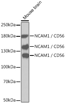 NCAM1 / CD56 Rabbit pAb