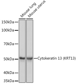 Cytokeratin 13 (KRT13) Rabbit mAb