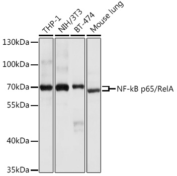 NF-kB p65/RelA Rabbit pAb