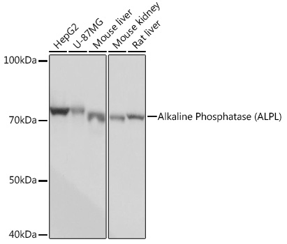 Alkaline Phosphatase (ALPL) Rabbit mAb