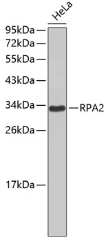 RPA2 Mouse mAb