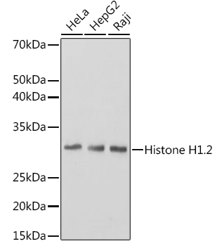 Histone H1.2 Rabbit mAb