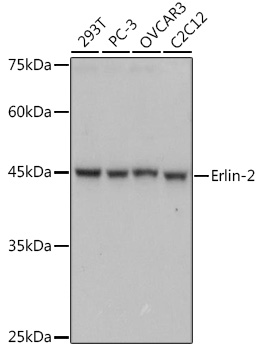 Erlin-2 Rabbit mAb