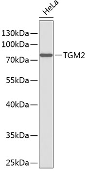Transglutaminase 2 (TGM2) Rabbit pAb