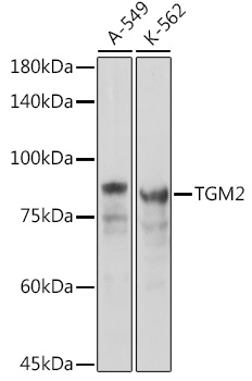 Transglutaminase 2 (TGM2) Rabbit pAb