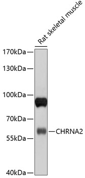 CHRNA2 Rabbit pAb