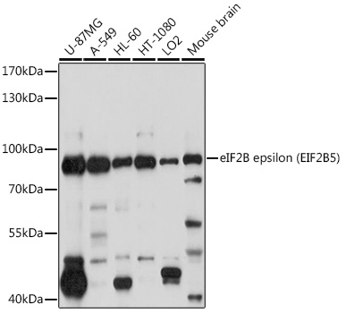 eIF2B epsilon (EIF2B5) Rabbit pAb