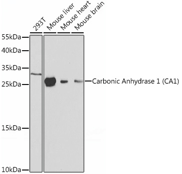 Carbonic Anhydrase 1 (CA1) Rabbit pAb