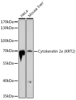 Cytokeratin 2e (KRT2) Rabbit pAb