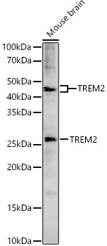 TREM2 Rabbit pAb