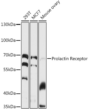 Prolactin Receptor Rabbit pAb