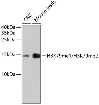 MonoMethyl/DiMethyl-Histone H3-K79 Rabbit mAb