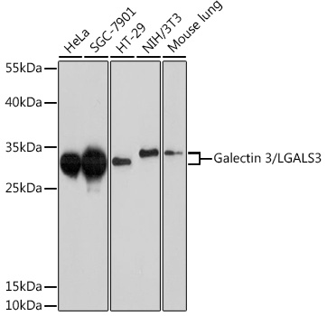 Galectin 3/LGALS3 Mouse mAb