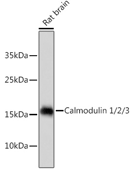 Calmodulin 1/2/3 Rabbit mAb