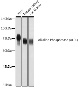 Alkaline Phosphatase (ALPL) Rabbit pAb