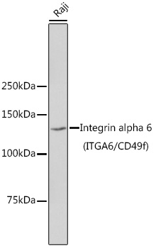 Integrin alpha 6 (ITGA6/CD49f) Rabbit mAb