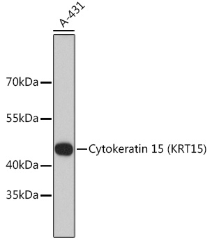 Cytokeratin 15 (KRT15) Rabbit mAb