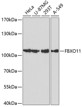 FBXO11 Rabbit pAb