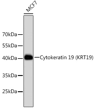 Cytokeratin 19 (KRT19) Rabbit mAb