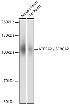 SERCA2/ATP2A2 Rabbit pAb