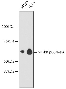 NF-kB p65/RelA Rabbit mAb
