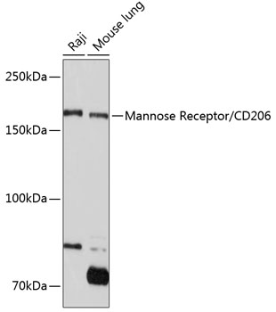 Mannose Receptor/CD206 Rabbit mAb
