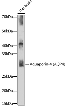 Aquaporin-4 (AQP4) Rabbit mAb