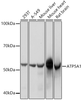 ATP5A1 Rabbit mAb