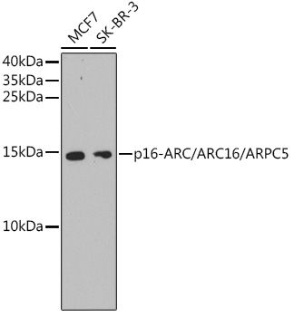 p16-ARC/ARC16/ARPC5 Rabbit mAb
