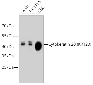 Cytokeratin 20 (KRT20) Rabbit mAb