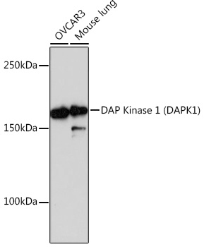 DAP Kinase 1 (DAPK1) Rabbit mAb