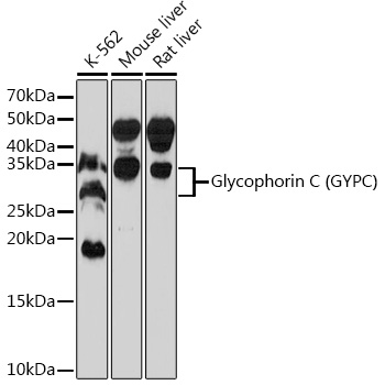 Glycophorin C (GYPC) Rabbit mAb
