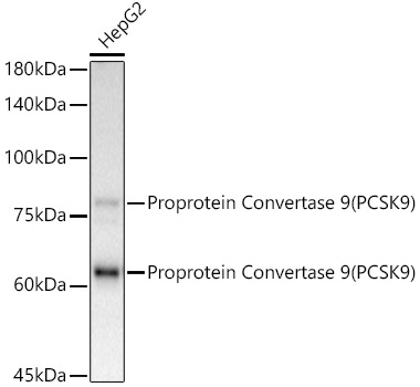 [KD Validated] Proprotein Convertase 9(PCSK9) Rabbit mAb