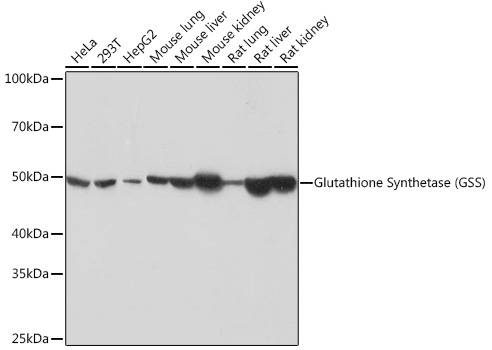 Glutathione Synthetase (GSS) Rabbit mAb