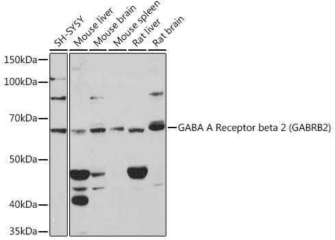 GABA A Receptor beta 2 (GABRB2) Rabbit mAb