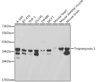 Tropomyosin 1 Rabbit pAb